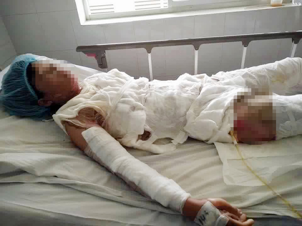Chị Bùi Thị Khê lúc còn đang cấp cứu ở bệnh viện - Ảnh: Quế Hà