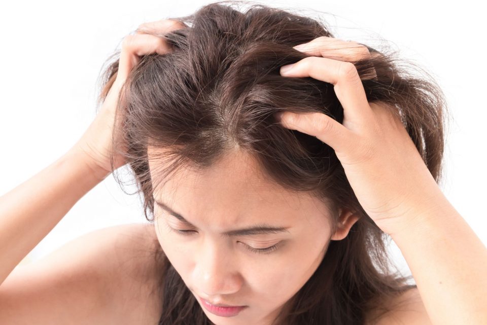 Stress ảnh hưởng như thế nào đến tóc và da đầu bạn