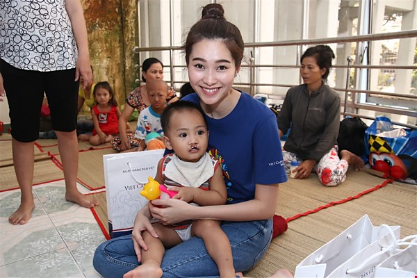 Dị tật sứt môi, hở hàm ếch là một trong những dị tật phổ biến nhất đối với trẻ sơ sinh tại Việt Nam. Trong ảnh: Hoa hậu Thu Thảo, đại sứ của Quỹ từ thiện Operation Smile, đến thăm các bệnh nhi 
trong một chương trình do quỹ này thực hiện năm 2014 - Ảnh: V.D
