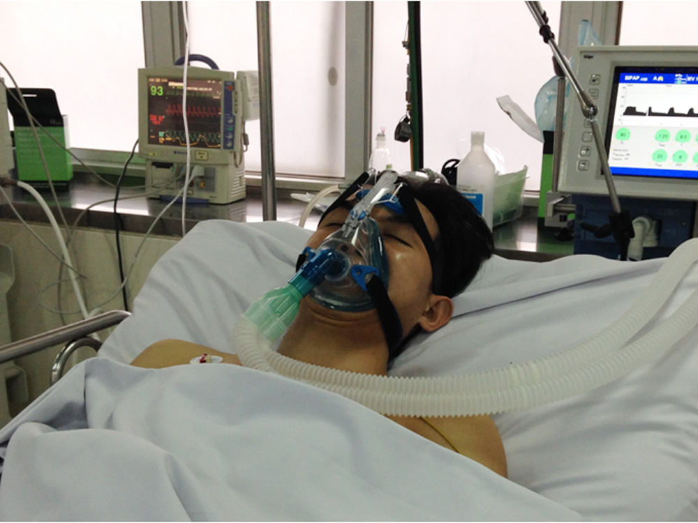 Bệnh nhân khi đang được điều trị tại Bệnh viện Chợ Rẫy - Ảnh: Bệnh viện cung cấp