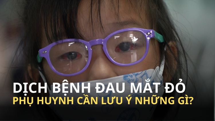 Dịch đau mắt đỏ dễ lây lan trong trường học, phụ huynh cần lưu ý gì?
