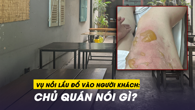 Toàn cảnh vụ nồi lẩu bò đổ vào người: Khách tố nhân viên không hỗ trợ, chủ quán 'phản pháo'