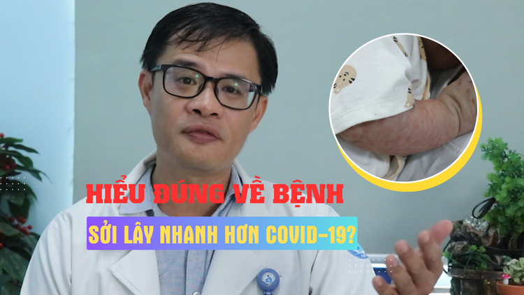 Dịch sởi có lây lan nhanh hơn Covid-19? - Hiểu đúng về bệnh