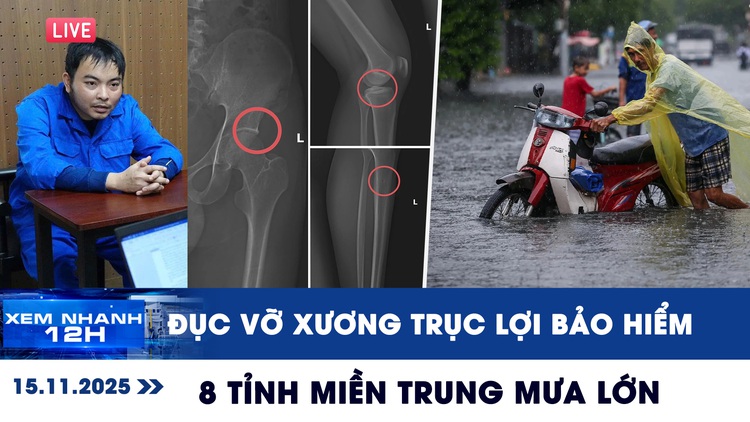Xem nhanh 12h ngày 15.11: Ớn lạnh chiêu trò đục vỡ xương trục lợi bảo hiểm | 8 tỉnh miền Trung mưa lớn