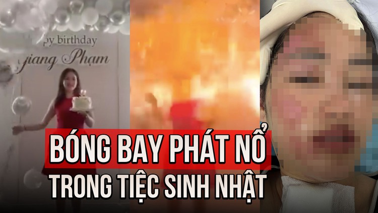 Sinh nhật kinh hoàng của cô gái Hà Nội: Bóng bay phát nổ, mặt bỏng nặng