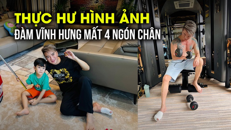 Động thái của Đàm Vĩnh Hưng trước thông tin mất gần cả bàn chân