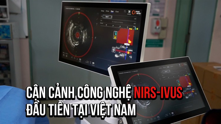 Cận cảnh công nghệ phát hiện xơ vữa, đánh giá nguy cơ nhồi máu cơ tim đầu tiên tại VN