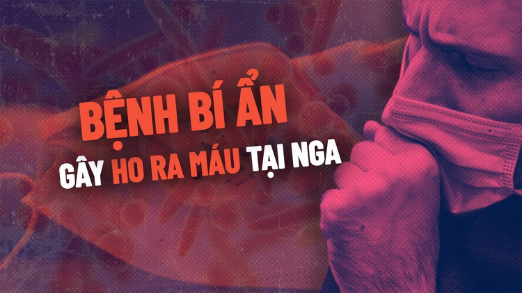 Bệnh hô hấp bí ẩn gây ho ra máu tại Nga: Việt Nam có đáng lo?