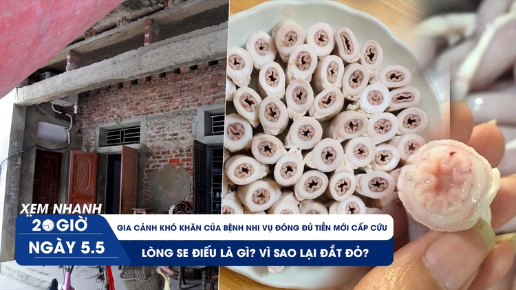 Xem nhanh 20h ngày 5.5: Lòng se điếu là gì? | Gia cảnh khó khăn của bệnh nhi vụ đóng đủ tiền mới cấp cứu