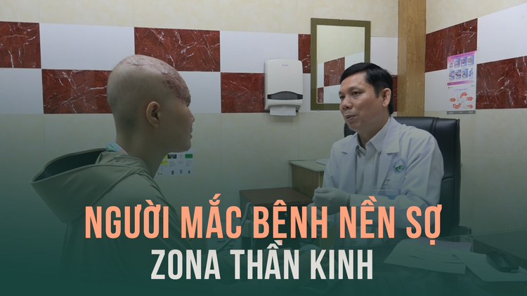 Zona thần kinh: nỗi ám ảnh của người mắc bệnh nền
