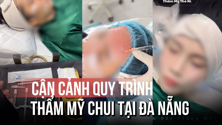 Thẩm mỹ 'chui' bủa vây: Cận cảnh quy trình làm đẹp không phép tại Đà Nẵng