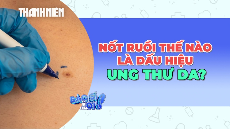 Cảnh báo những nốt ruồi bất thường là dấu hiệu của ung thư da
