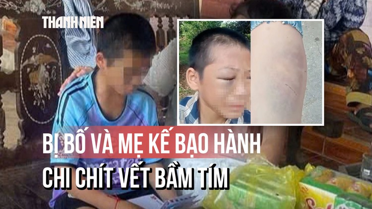 Toàn cảnh vụ bé trai nghi bị bố và mẹ kế bạo hành: Đã nhập viện với chi chít vết bầm tím