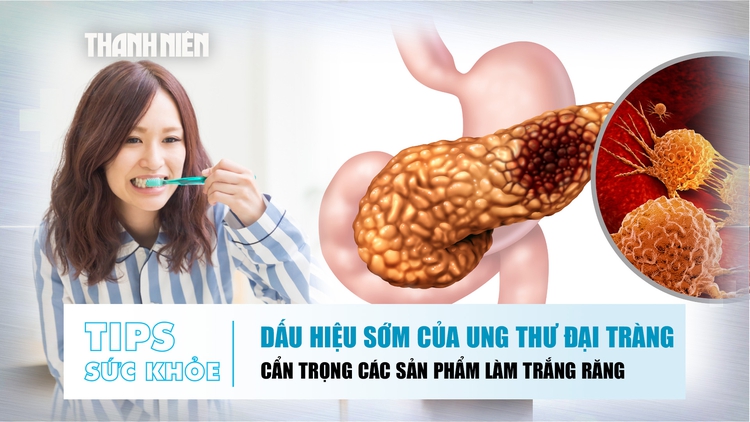 Bản tin sức khỏe 2.9: Dấu hiệu của ung thư đại tràng | Cẩn trọng sản phẩm làm trắng răng