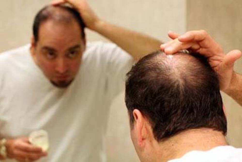 Dấu hiệu nhận biết, nguyên nhân và cách chữa rụng tóc hiệu quả