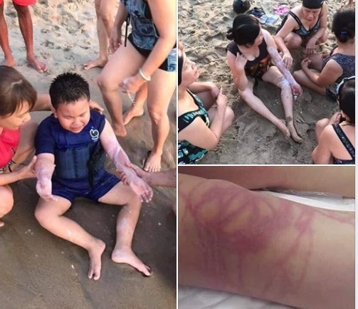Nóng trên mạng xã hội: Cảnh báo “sứa biển cắn người” gây hoang mang