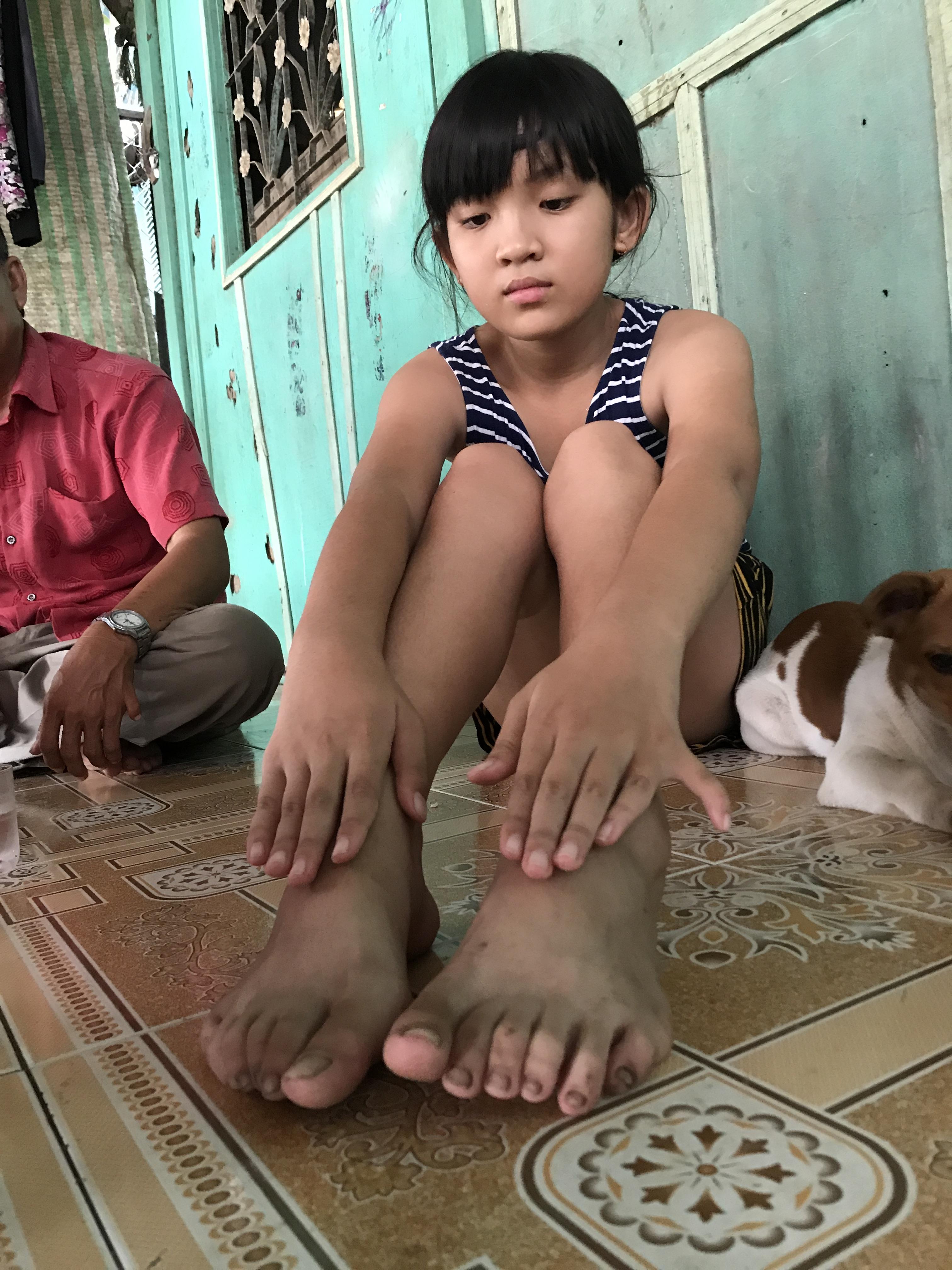 Dị nhân miền Tây: Gia đình 3 thế hệ có 24 ngón tay, chân ở miền Tây