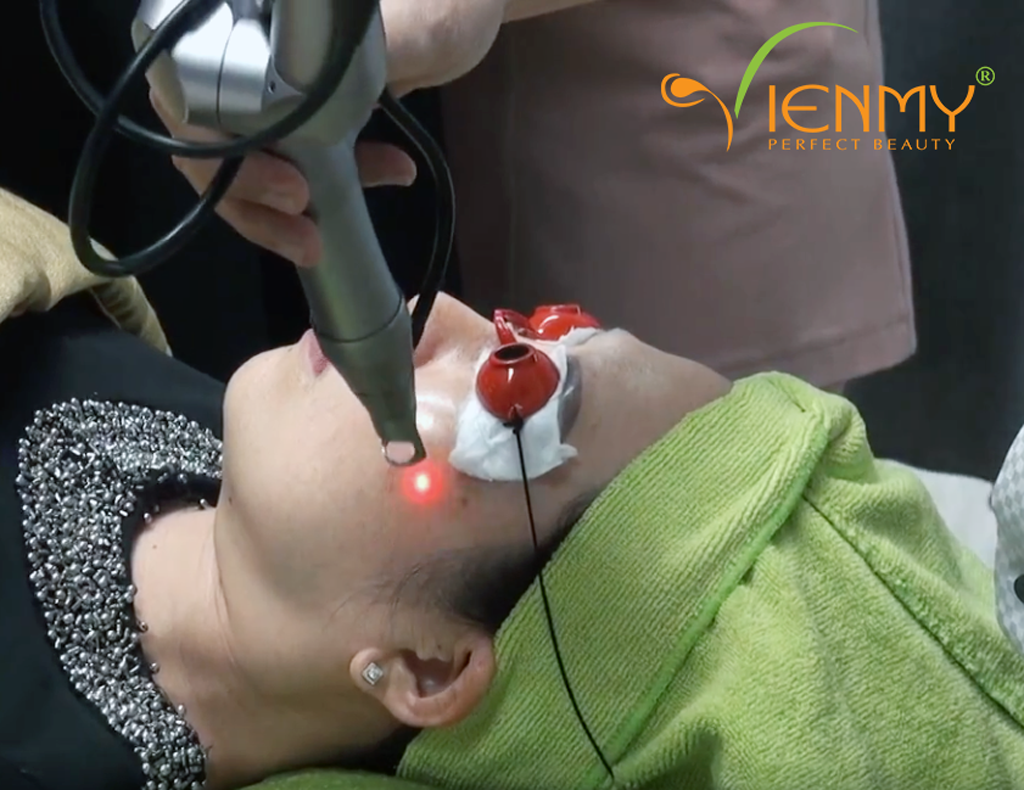 Công nghệ laser trị nám đem lại kết quả tích cực, nhanh chóng, hiện đại