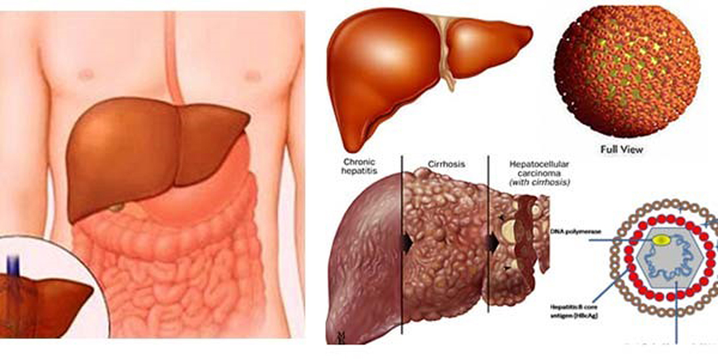 Fucoidan hỗ trợ giải độc gan hiệu quả