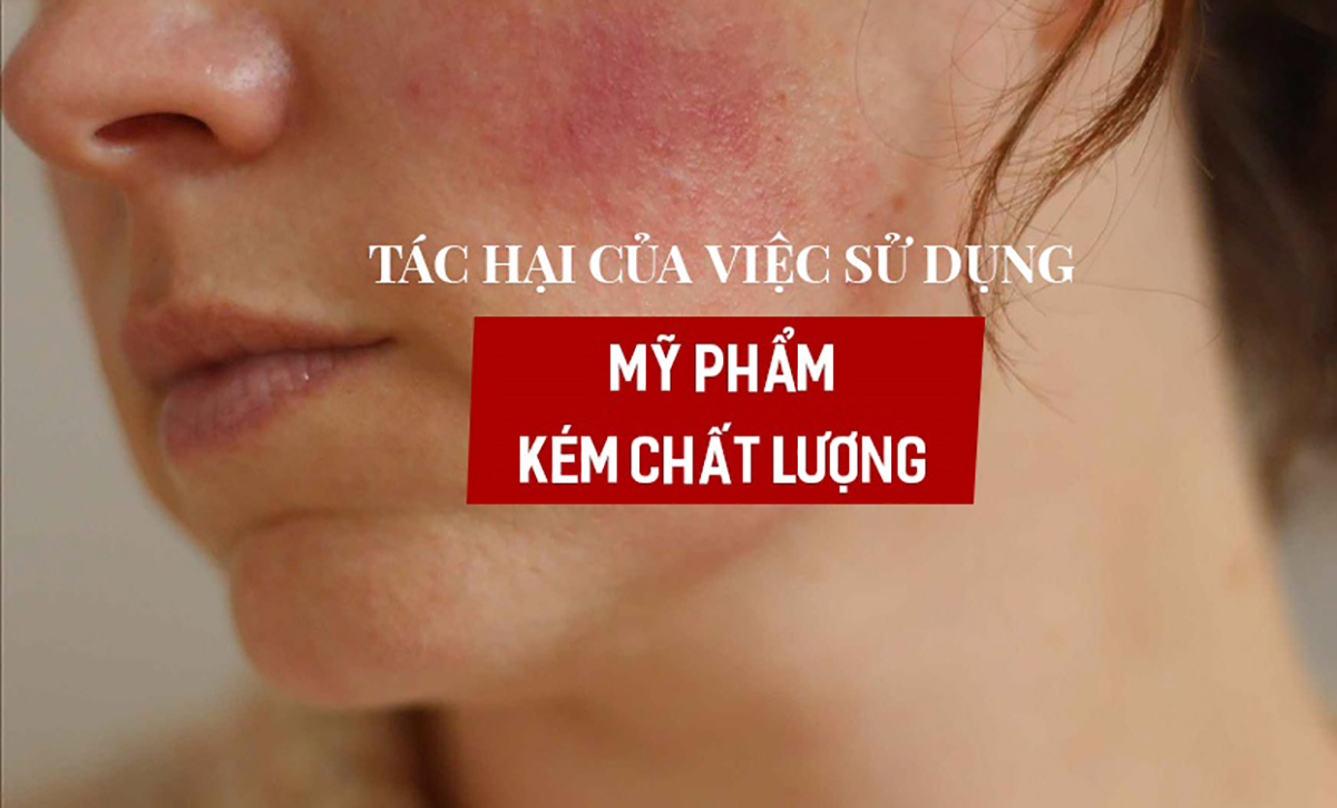 Nhiều chị em mua phải kem White Doctors kém chất lượng và làn da bị tổn thương nghiêm trọng