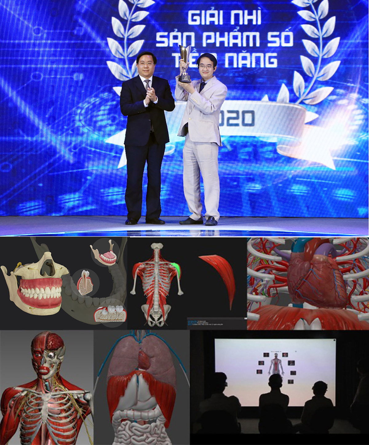TS Lê Nguyên Bảo - Hiệu trưởng ĐH Duy Tân nhận giải thưởng (ảnh trên) và Ứng dụng 3D trong Y học