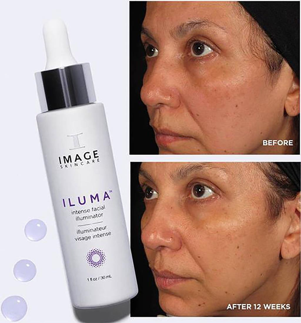 Hiệu quả trị nám sau 12 tuần sử dụng serum Image Iluma Intense Facial Illuminator