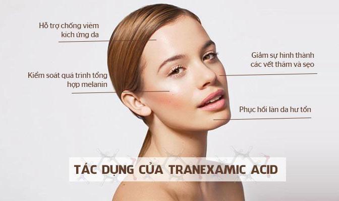 Tranexamic Acid là hoạt chất điều trị sắc tố da hiệu quả hiện nay