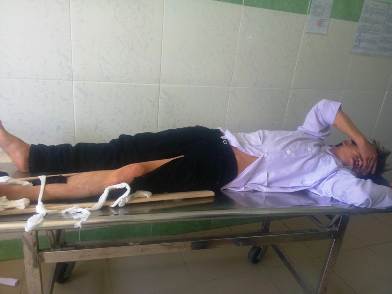 Anh Ẩn bị thương nặng đang được cấp cứu ở bệnh viện - Ảnh: Đức Tiến 