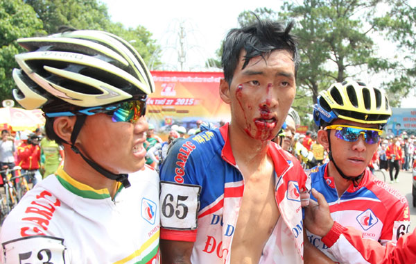 Tay đua Nguyễn Nhật Nam kiên quyết không bỏ cuộc dù bị ngã chảy máu - Ảnh: Khả Hòa