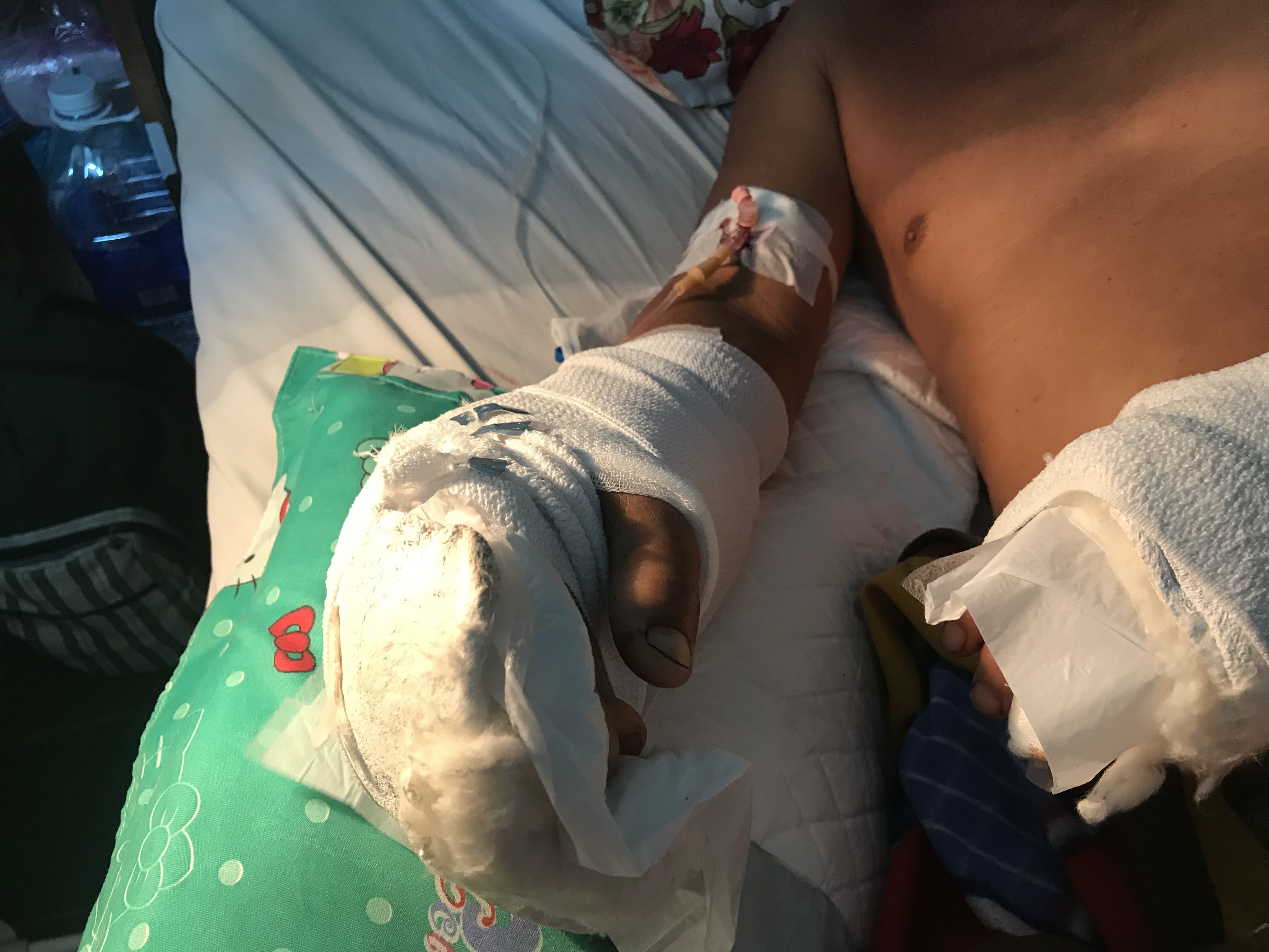Vụ gia đình bị chém ở Tây Ninh: Ám ảnh giây phút bàn tay đứt lìa