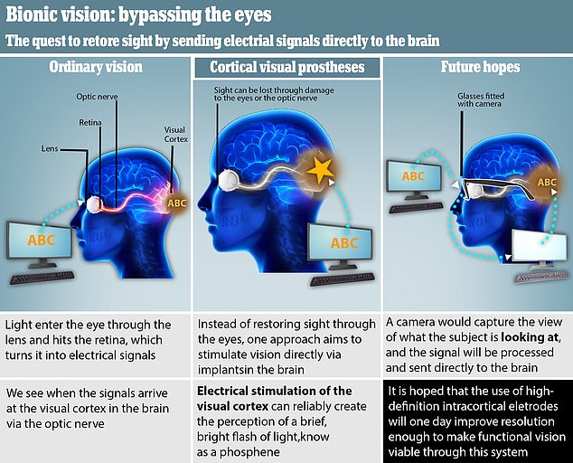 Cấy ghép thị giác nhân tạo cho người khiếm thị