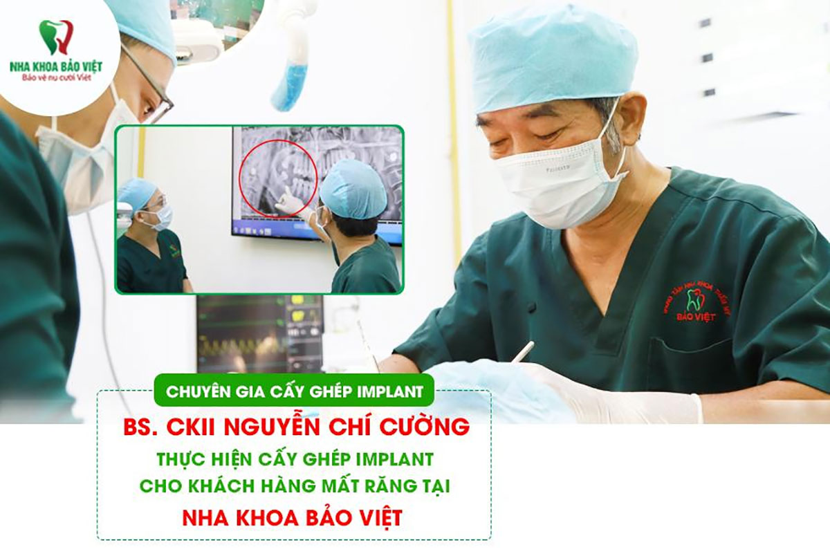 BS.CKII Nguyễn Chí Cường thực hiện cấy ghép Implant tại Nha khoa Bảo Việt