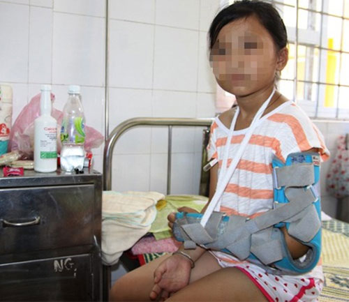 Vụ bé gái 10 tuổi bị cha ruột đánh đập dã man như cơm bữa: Khởi tố người cha tàn ác