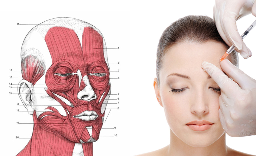Tiêm Botox có ảnh hưởng thần kinh, làm cho mặt bị 'đơ', căng cứng? 2