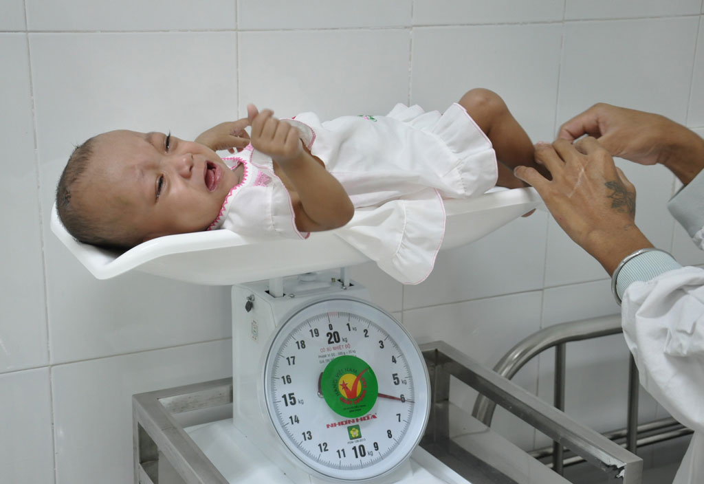 437 ngày nằm trong bệnh viện của 2 bé song sinh dính nhau 2