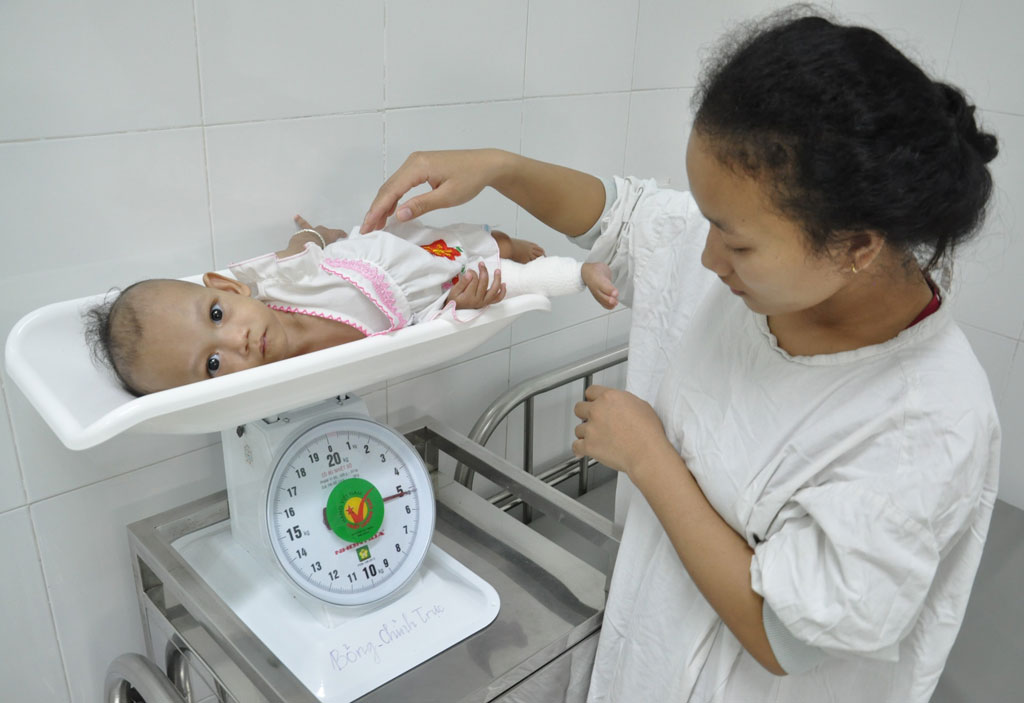 437 ngày nằm trong bệnh viện của 2 bé song sinh dính nhau 3