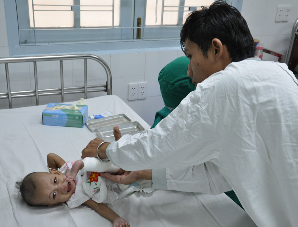 437 ngày nằm trong bệnh viện của 2 bé song sinh dính nhau 6