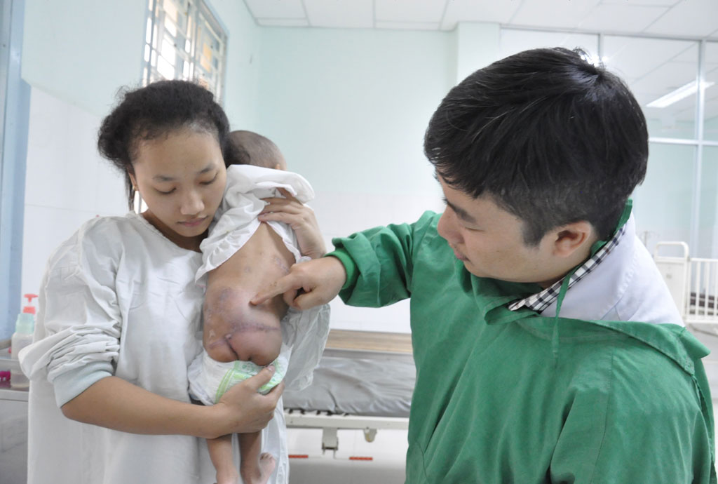 437 ngày nằm trong bệnh viện của 2 bé song sinh dính nhau 8