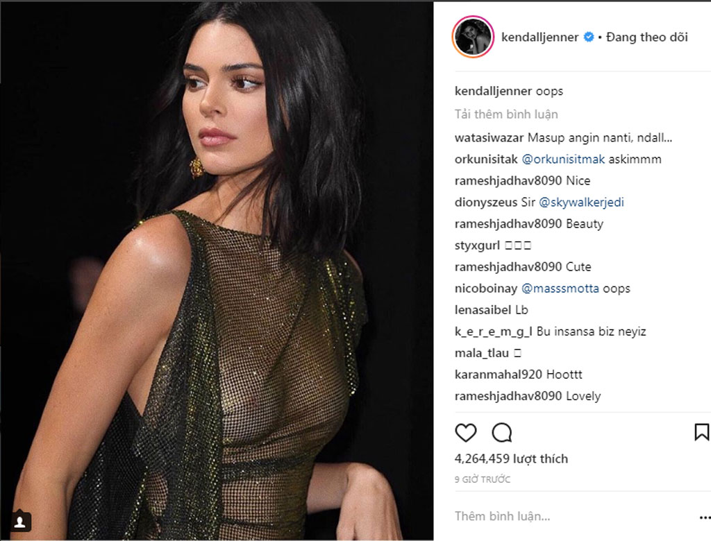 Kendall Jenner khoe vòng một căng tròn1