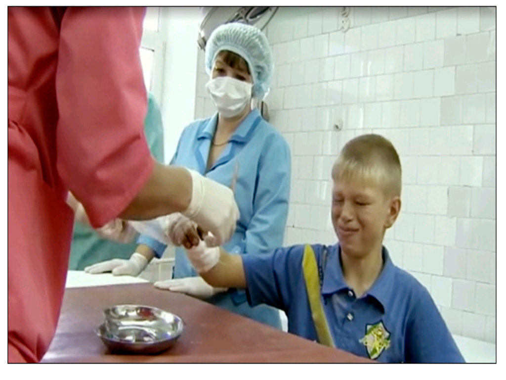 Cậu bé Nikita Nikonov đang được chữa trị vết thương - Ảnh chụp màn hình The Siberian Times