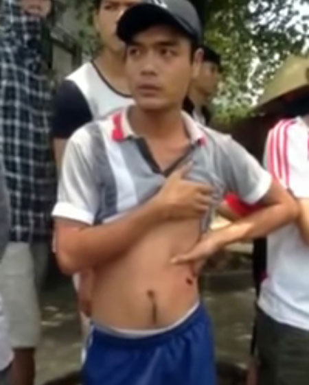 Nguyễn Thanh Nghĩa bị thương nhẹ ở hông do đạn cao su - Ảnh cắt từ clip do người dân cung cấp