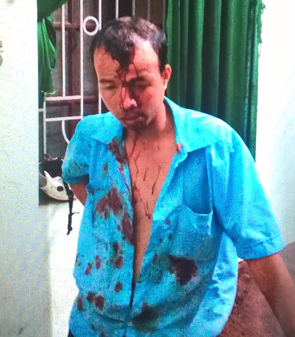 Nhân viên Trịnh Quang Sơn bị đánh chảy máu đầu 