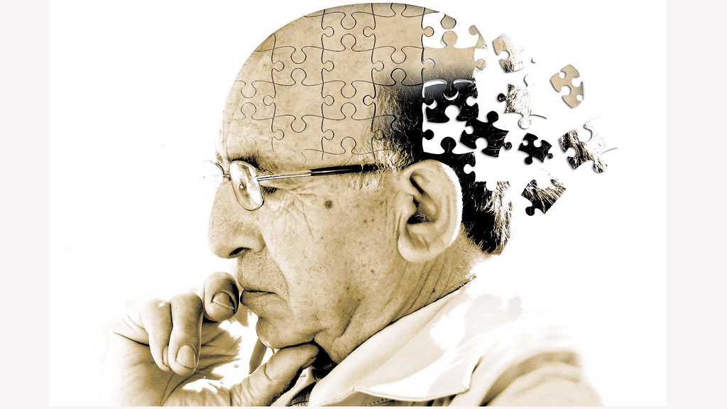 Alzheimer là một chứng bệnh mà người cao tuổi thường mắc phải.