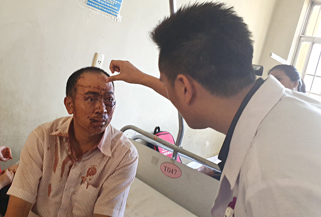 Anh Trần Văn Thành bị nhiều vết cắt trên mặt, may mắn vợ con chỉ bị thương nhẹ