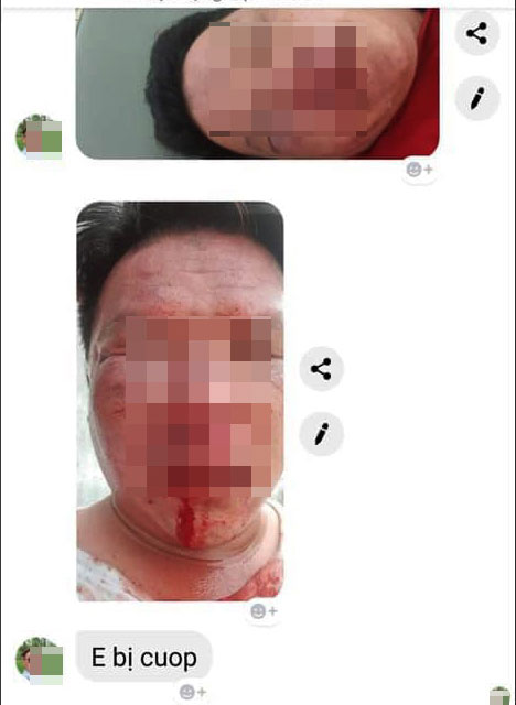 Tin nhắn của nạn nhân gửi một người bạn báo mình bị cướp