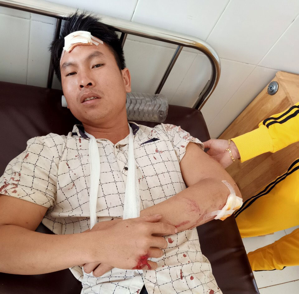 Nạn nhân Trần Văn Sơn tại bệnh viện Phan Bá