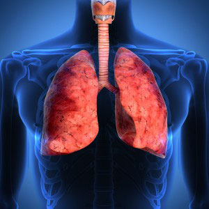 Ung thư phổi là nguyên nhân gây ra nhiều ca tử vong hơn Shutterstock