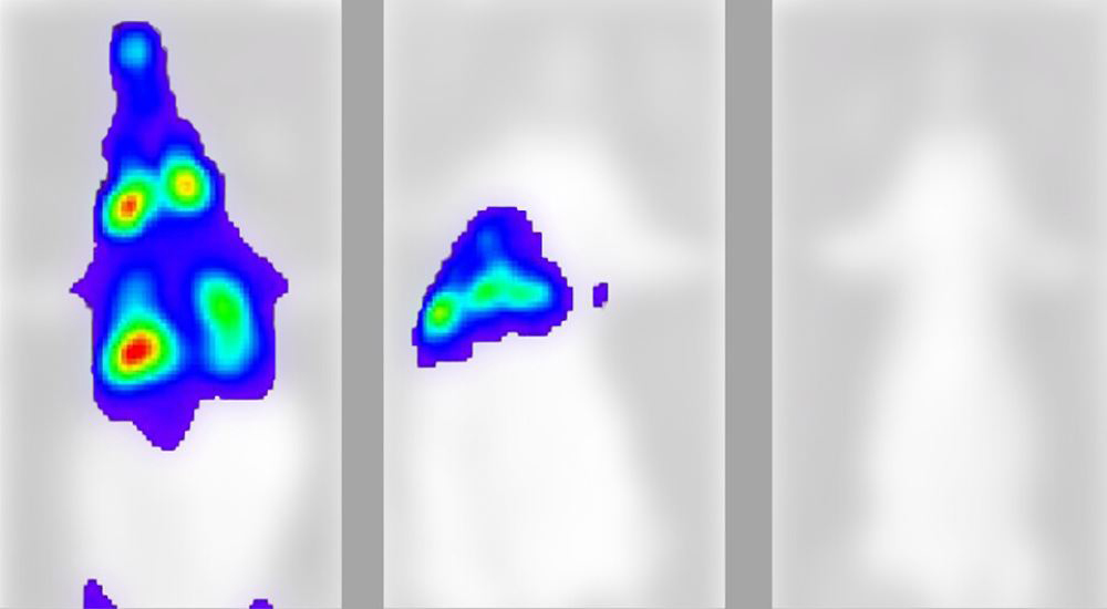 Hình ảnh 3D của virus Covid-19 khi chưa có kháng thể, cung cấp kháng thể 3 ngày sau khi nhiễm bệnh và cung cấp kháng thể trước khi nhiễm bệnh Shutterstock