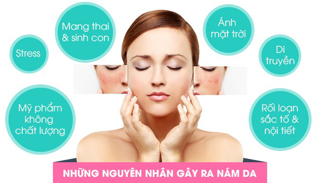 Những nguyên nhân gây nám da