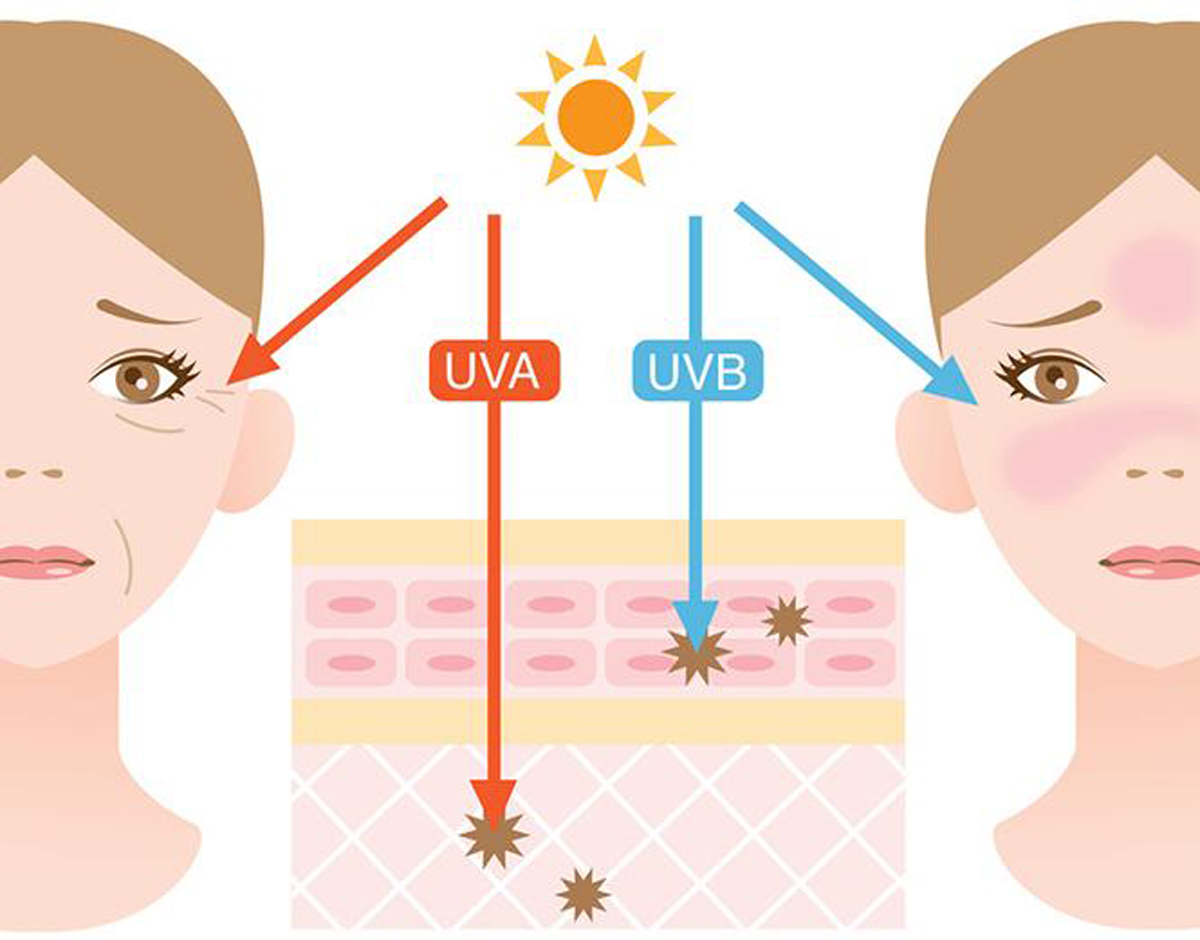 Sự tàn phá của tia UV đối với làn da 